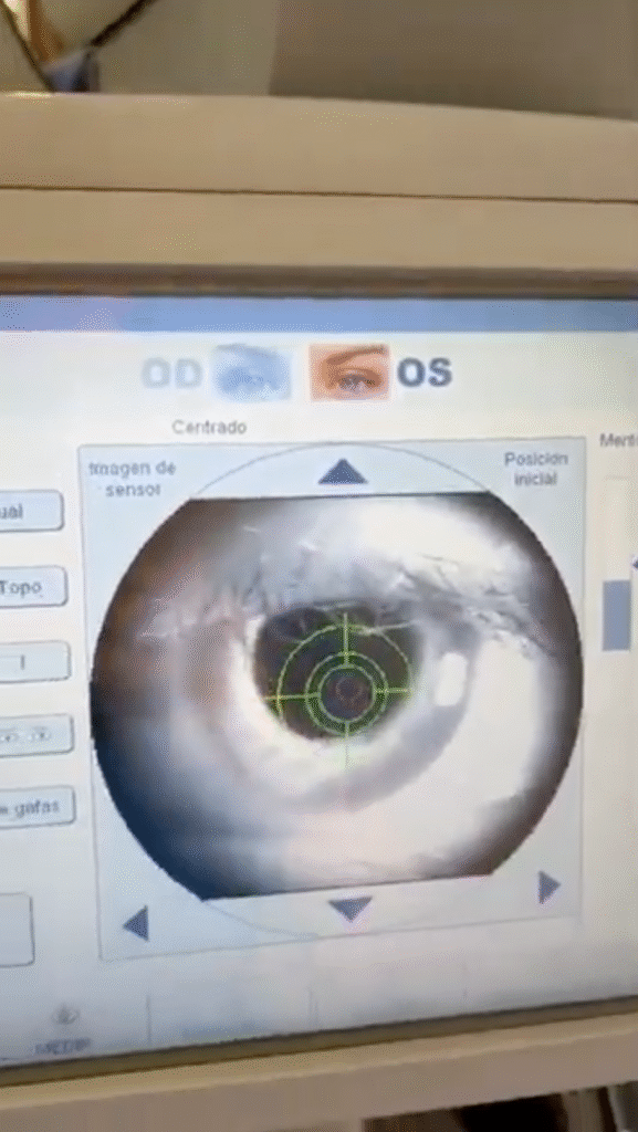 i-profiler-ZEISS